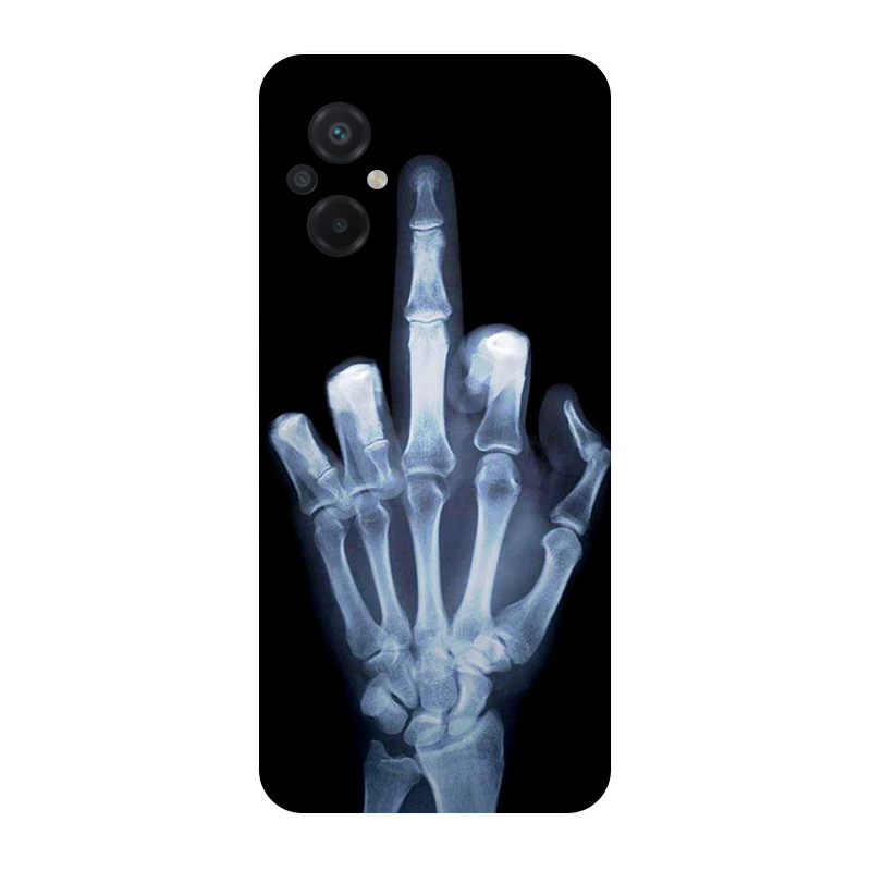 for Poco M5 2022 4G Case Footb - Phone Cases Liverpool recensie en prijs